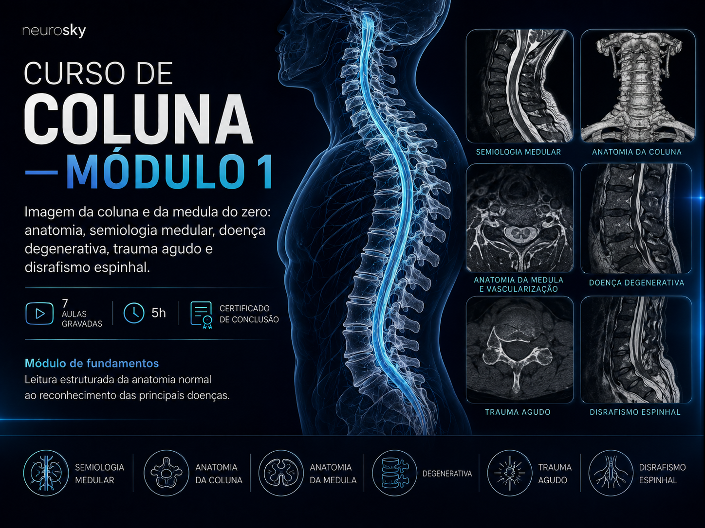 Capa do curso Curso de Coluna - Módulo 1